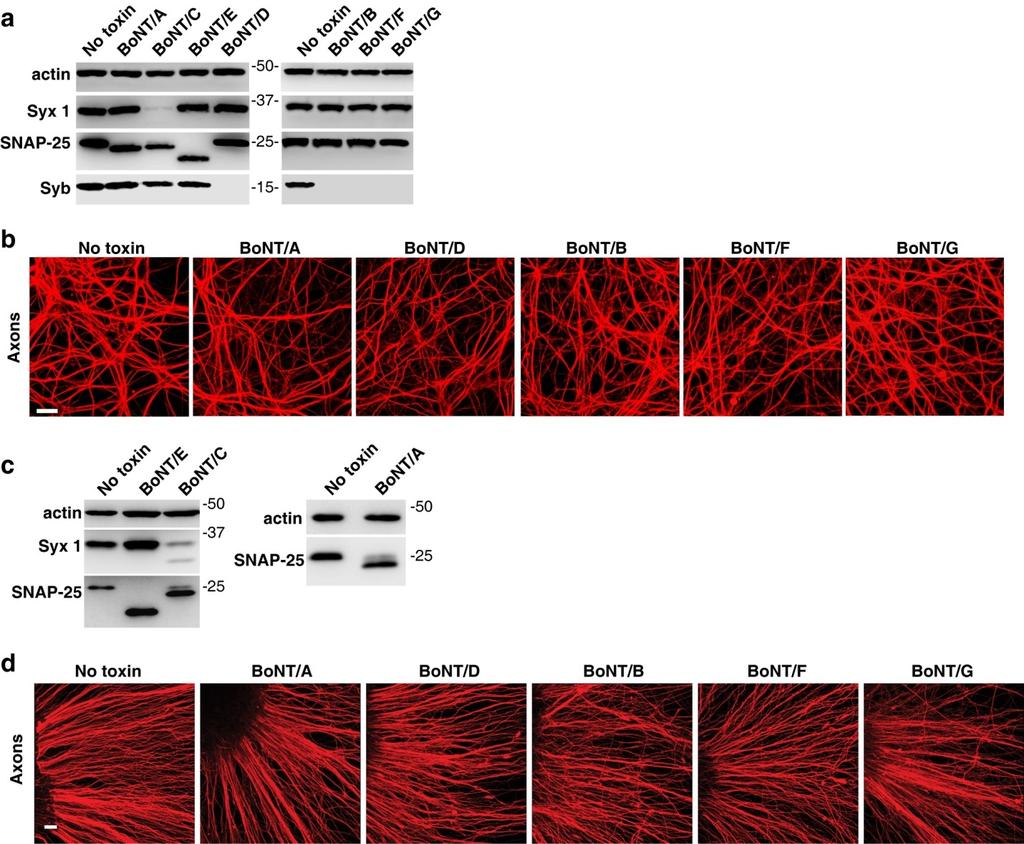Supplementary Figure S3. BoNTs other than C and E do not induce axon degeneration in rat and human motor neurons. (a) Cultured rat motor neurons were exposed to the indicated BoNTs for 12 hrs.