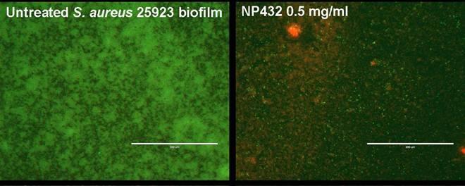 NP432 NP432 is a Potent Disrupter of Bacterial Biofilms Impact of NP432 on biofilms of clinically