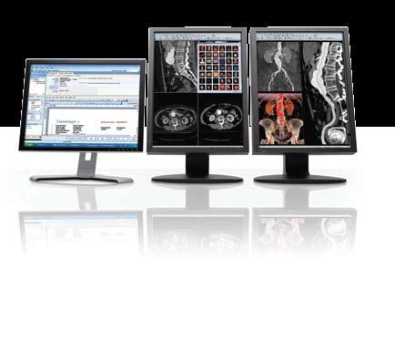 CARESTREAM RIS/PACS SuperPACS Architecture A Changing Landscape The field of radiology is in a constant state of acceleration and evolution.