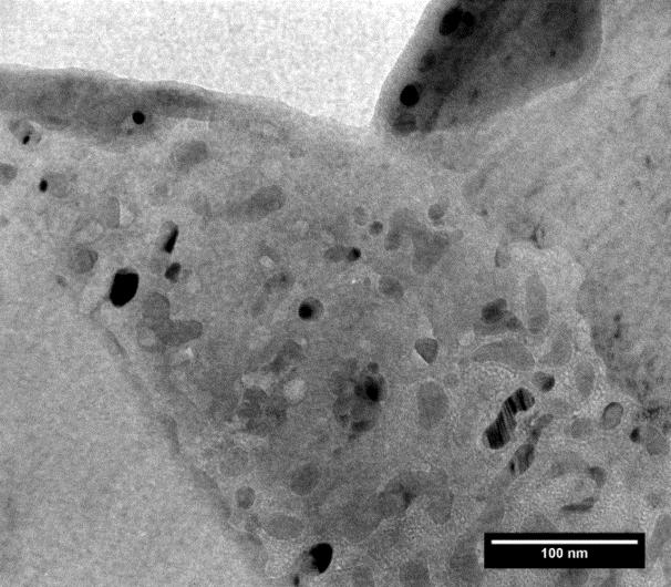 4: Transmission electron micrographs and