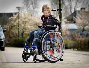 Duchenne Muscular Dystrophy Rapid progression of muscle degeneration, due to the absence of dystrophin Affects 1 in 3,500 newborn males* Age Rare, severely debilitating progressive