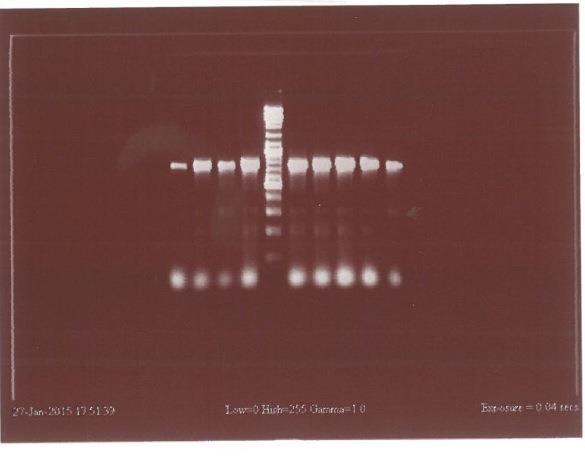 DNA Sequencing The PCR products were sent to the