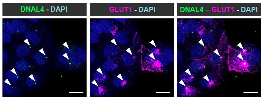 Supplementary Figure 1. Co-localization of GLUT1 and DNAL4 in BeWo cells cultured under static conditions.