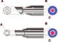 Surgery Cataract Figure 1: Comparative Sectional Representations of the easytip and Standard Tip Figure 2: easytip Designs for All Incision Sizes A B easytip 2.2mm easytip COMICS easytip 2.