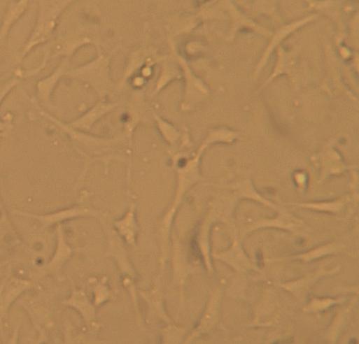 Cells for cartilage TE Stem cells Chondrocytes
