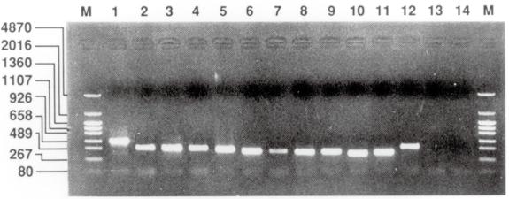 IX. Application (Detection results with 11 species of Mycoplasma and 1 species of Ureaplasma using PCR) DNA was extracted from cultured Mycoplasma (11 species) and Ureaplasma (1 species).