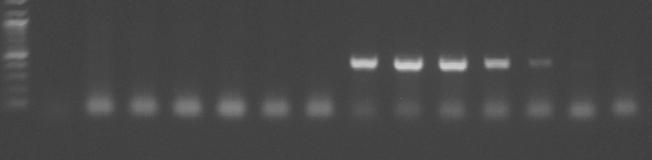 Panels A and B show the results of PCR with DNA isolated from rat and human fecal samples, respectively, using primers specific for prokaryotic 16S rrna.