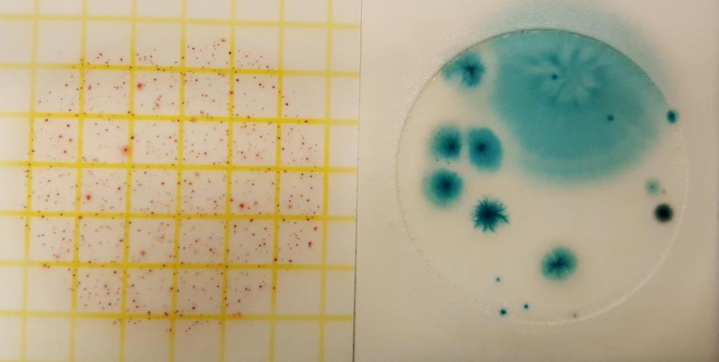 Methods: Counting Image J & Scoring Chart Total Aerobic Bacteria Total Yeast