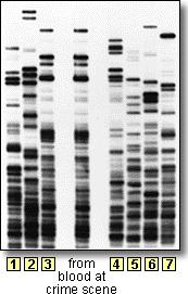 55-56 DNA samples were recovered from a crime scene, and DNA fingerprints were made. The gel of these samples appears below. 55. Which suspect is probably guilty of the crime?
