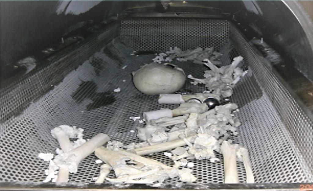 Bio Cremation Remains Medical Implants
