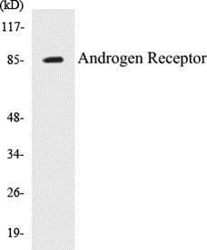 Anti-Androgen Receptor Antibody The Anti-Androgen Receptor Antibody is a rabbit polyclonal antibody. It was tested on Western Blots for specificity.