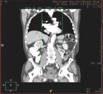 Data: Improvements in Cancer Staging with PET/CT: Literature-Based