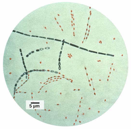 OpenStax-CNX module: m49667 13 Figure 5: Bacillus anthracis is the organism that causes anthrax. (credit: modication of work by CDC; scale-bar data from Matt Russell) 3.