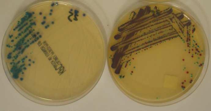 Colorex KPC (CHROMagar) chromid CARBA Pure growth of blue colonies of C. freundii with NDM-1 enzyme on Colorex KPC medium (left).