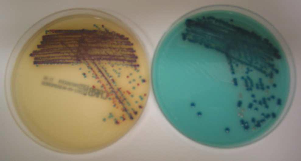 Fig. 1: E. coli (pink/red colonies) and K.
