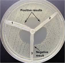 Hodge test: Can be useful if you obtain a strong positive result but sensitivity and specificity are not great and better tests are available. e.g. Sensitivity for detection of MBLs has been found to be as low as 12%.