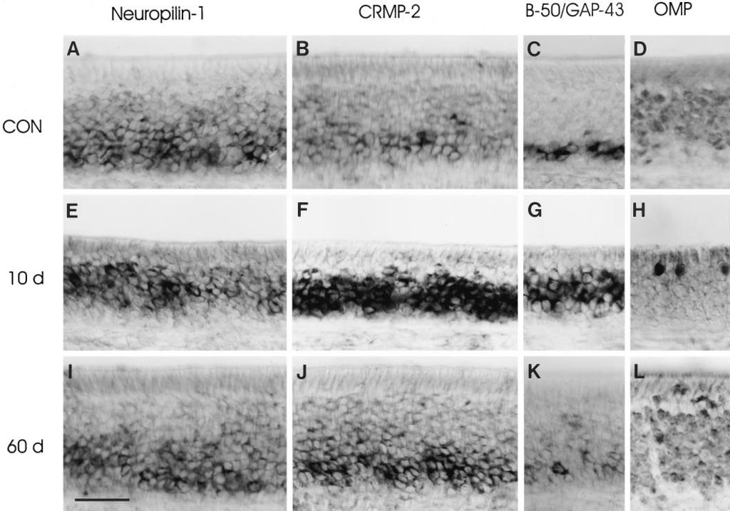 Pasterkamp et al. Semaphorin III in Olfactory Nerve Regeneration J. Neurosci., December 1, 1998, 18(23):9962 9976 9971 Figure 6.