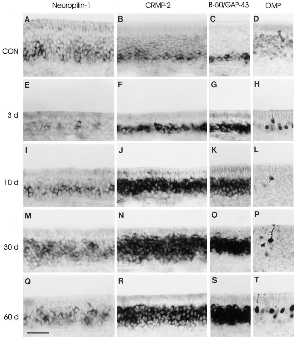 9966 J. Neurosci., December 1, 1998, 18(23):9962 9976 Pasterkamp et al. Semaphorin III in Olfactory Nerve Regeneration Figure 2.