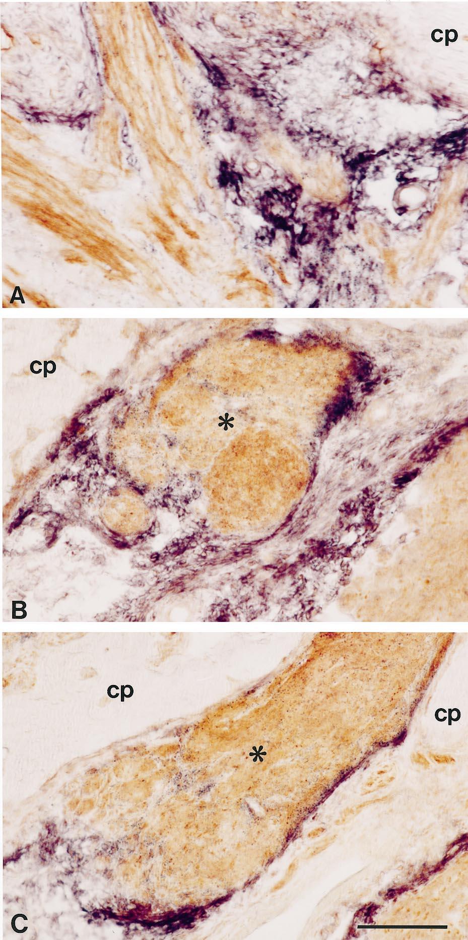 9970 J. Neurosci., December 1, 1998, 18(23):9962 9976 Pasterkamp et al. Semaphorin III in Olfactory Nerve Regeneration extension into deeper portions of the bulbar cavity (Fig. 8).