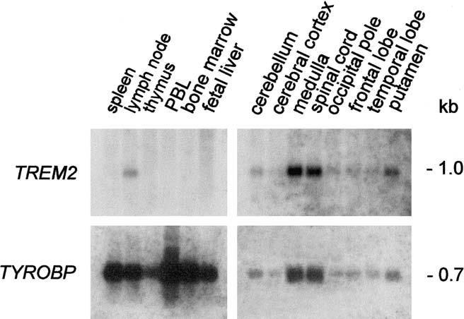 660 Am. J. Hum. Genet. 71:656 662, 2002 Figure 3 Northern-blot analysis of human tissues, with radiolabeled human TREM2 and TYROBP cdnas used as probes.