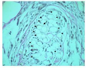 PLGA/Bioglass composite mesh In-vivo assessment of neovascularization The presence of