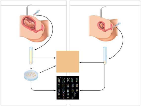 Fetal Testing In amniocentesis, the liquid that bathes the fetus is removed and tested In chorionic villus sampling (CVS), a sample of the placenta is removed and tested Other techniques, such as