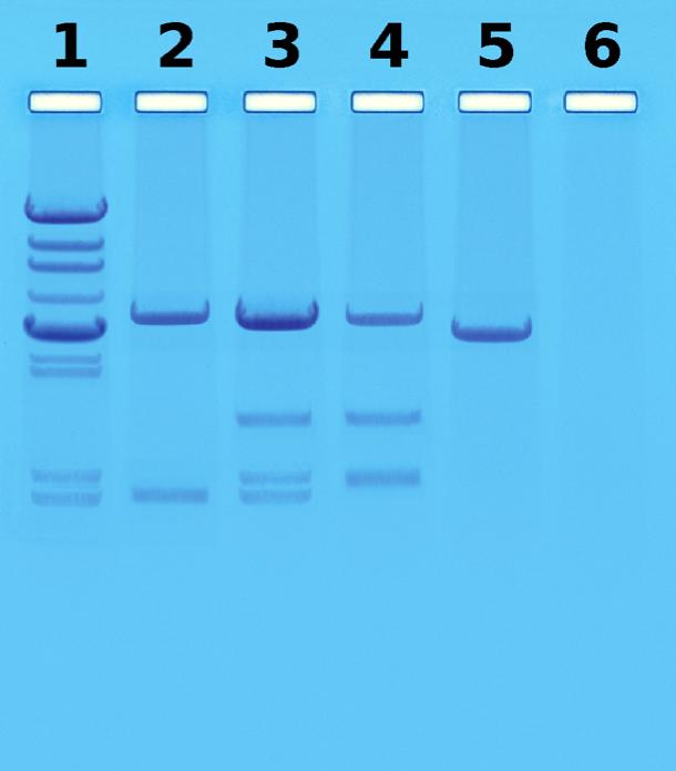 DNA Fingerprinting is Used to Determine Paternity Parentage can be determined from a child s DNA profile.