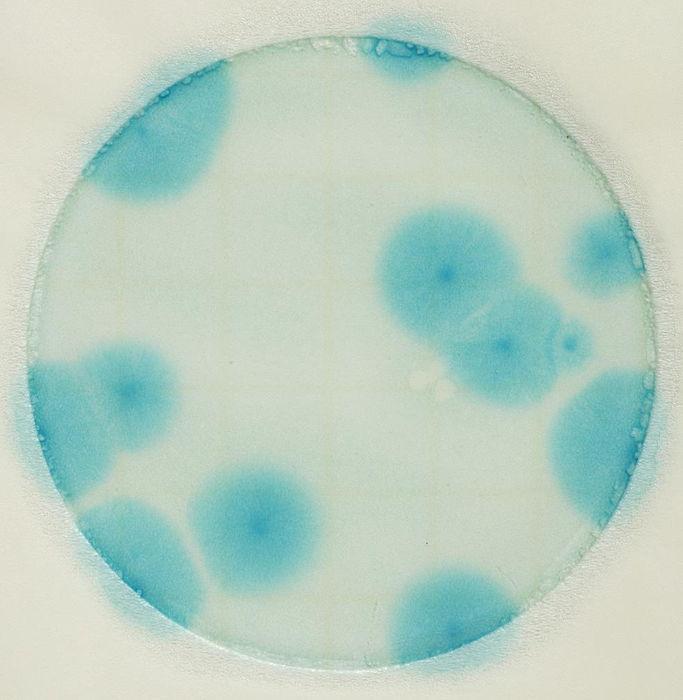 Yeast count = 44 The colonies are examples of characteristic yeast: small colonies, colonies have defined edges, pink-tan to blue-green in colour, colonies