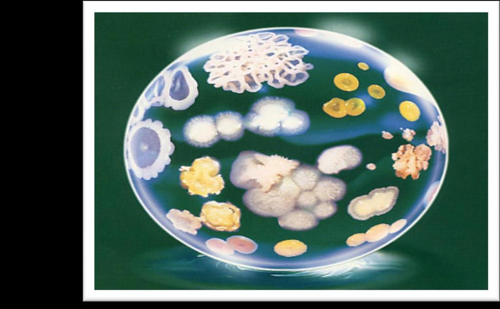 The purpose of studying microbial control is far ranging