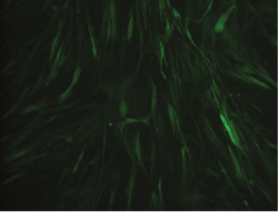 6 Trans 96 h Trans 8 d (b) (c) Figure 1: Characterization of human mesenchymal stem cells expressing firefly luciferase and green fluorescent protein reporter genes.