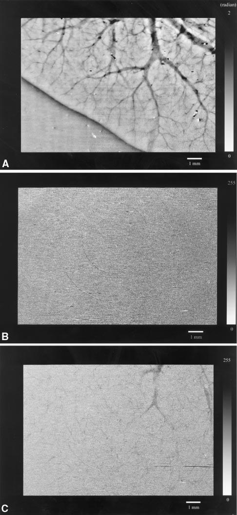 1710 Circulation April 9, 2002 Figure 2. Comparison of measured difference of refractive index d between candidate contrast agent and water (cross-hatched bar) and theoretical value (solid bar).