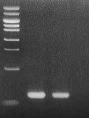 B-2) Amplification of K-ras gene (107 bp) M 1 2 107 bp Lane M: phy Marker (100 ng) Template : Lane 1 : 5 μl of DNA extracted with a conventional method Lane 2 : 5 μl of DNA extracted using DEXPAT
