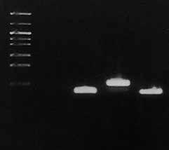 B-3) Amplification of p53 gene (273 bp), exon 6 gene (207 bp) M 1 2 3 4 Lane M: phy Marker (100 ng) 273 bp 207 bp [1st PCR] Template : Lane 1, 2 : 5 μl of DNA extracted with a conventional method