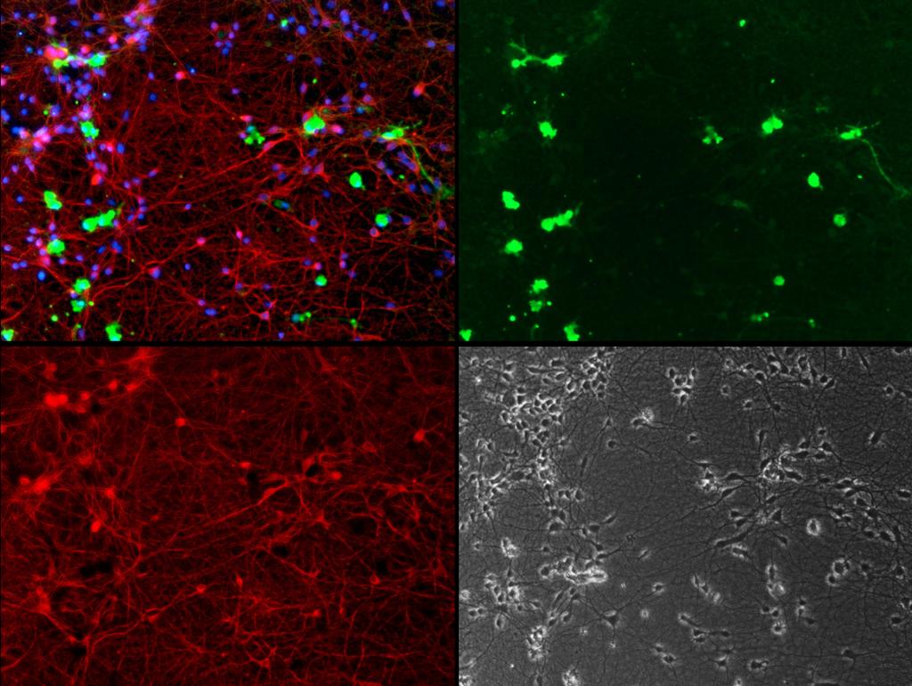Application protocol: IBA (G) TUJ1 (R) DAPI (B) 20X Notes In co-culture, neurons and microglia survive for at least 2 months without obvious proliferation of microglia.