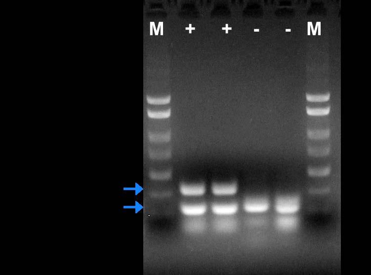 Figure 1: A representative 1X TAE, 1.4 % agarose gel showing the amplification of Parvovirus B19 at different concentrations.