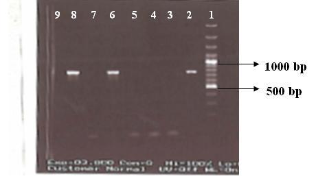 Dallal et al. 5521 Figure 1. Lane 1, 100 bp DNA marker; lane 2,