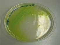 (B) Bacterial pigments: Endopigment: Exopigment: Localized inside the organism and giving