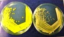Example: Golden yellow pigment of Staphylococcus aureus.