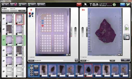 TMA HARDWARE By producing smaller and higher capacity fully automated tissue microarrayers, 3DHISTECH is able to give a suitable TMA solution for the majority of customers.