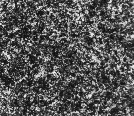 Figure 10-9 The microstructure of bainite involves extremely fine needles of α-fe and Fe 3 C, in contrast to the lamellar structure of pearlite