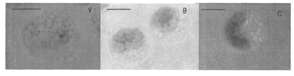 96 () 2008 4 A : ;B :;C : ;Bar :5m Fig. 4 Staining of Sepiella maind roni hyalinocytes 5 A : ;B :;C : ;Bar :5m Fig. 5 Staining of Sepiella maind roni granulocyte,, 2,45. 3 %, 54. 7 %(1). (1) :,, 7.