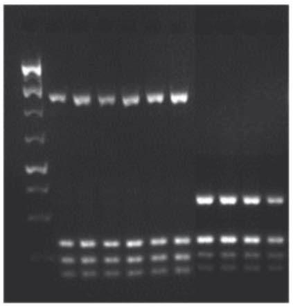 Methods for characterising resistance to carbamates, pyrethroids and neonicotinoids in Myzus persicae Simultaneous detection of the modified acetylcholinesterase (MACE) and sodium channel kdr