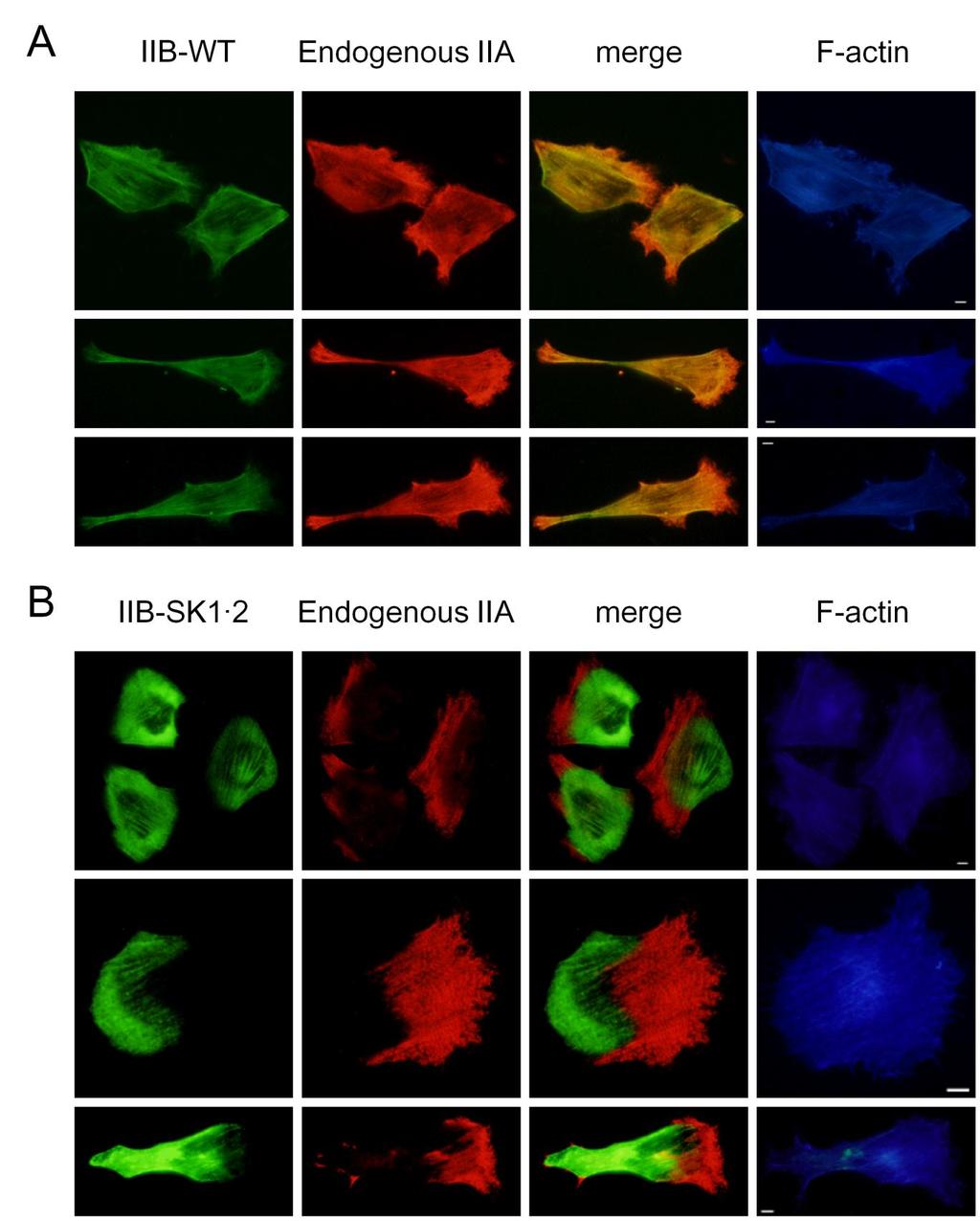 Supplemental Figure S4 Figure S4. Localization of endogenous myosin IIA in HeLa Tet-Off cells expressing EGFP-IIB-WT (A), or EGFP-IIB-SK1 2 (B).