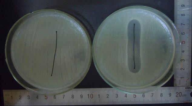 a. b a. b 1) S. aureus 2) E. coli Figure 4 Zone of inhibition assay a. untreated, b. treated 3.