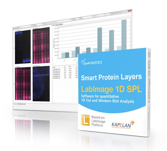 SPL-LabImage Software Fast and accurate data processing and evaluation Accurate evaluation requires several data processing steps.