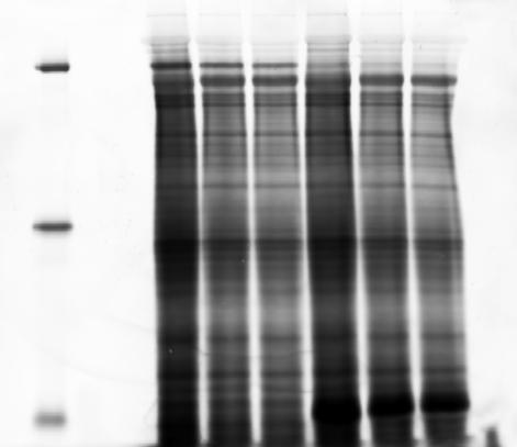 The Smart Label Monitoring total protein during every step of the Western procedure Protein transfer and subsequent Western blot procedure (e.g. washing steps with TBST) lead to inconsistent loss of total protein.