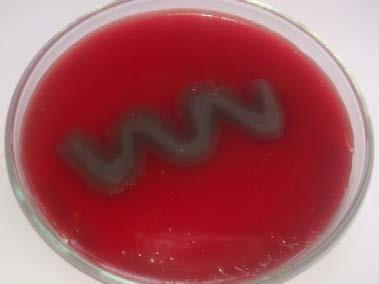 Figure 4 Foaming activity d) Hemolysis- Presence of clear zone indicates the