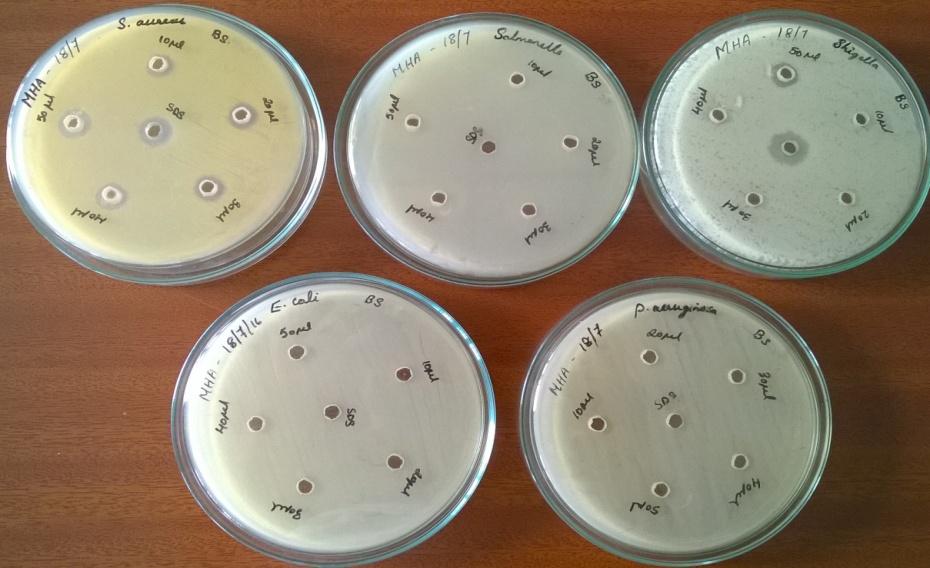 Figure 8 Thin layer chromatography Antimicrobial Activity of Biosurfactant A clear zone was observed on both plate having Staphylococcus aureus and Shigella boydii with BS concentration of 20 mg/ 10