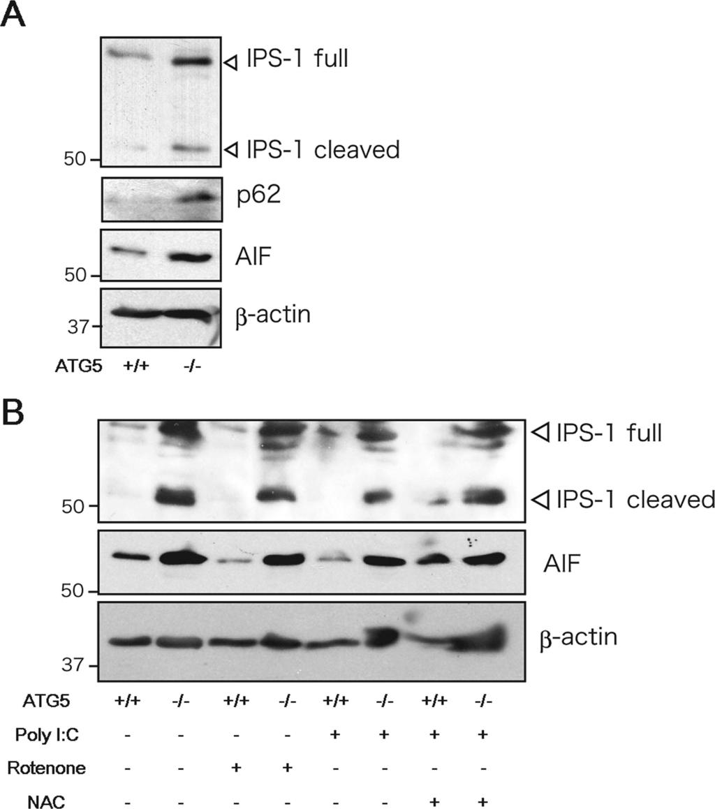 Fig. S4. IPS-1 protein analysis by Western blot.