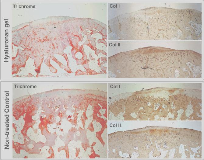 Regenerates healthy cartilage to potentially treat arthritis Rabbit model: Collagen